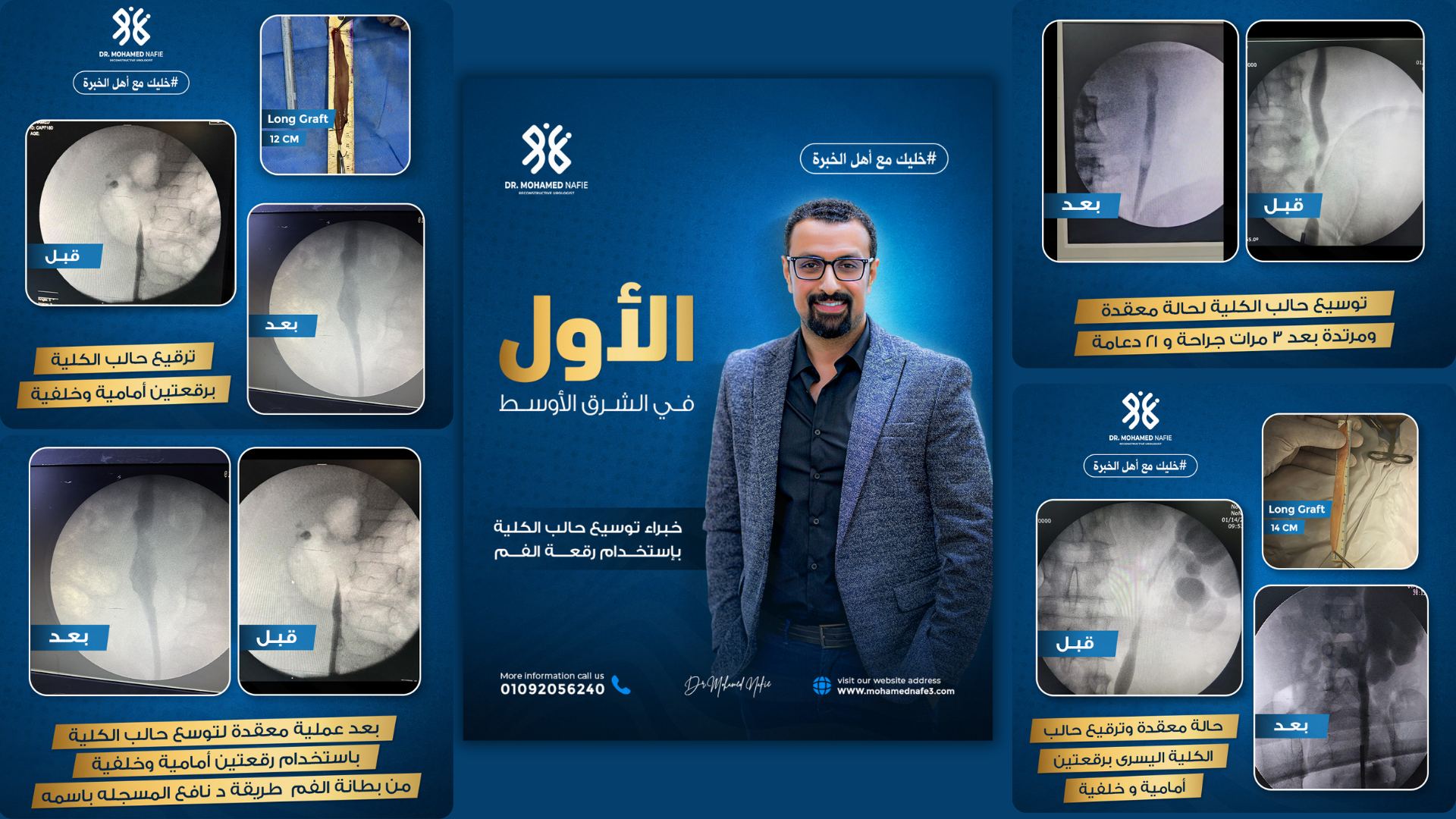 جراحات الحالب