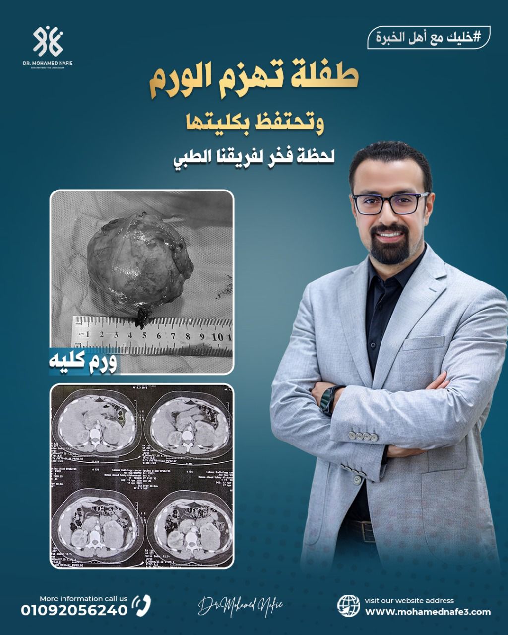  طفلة تهزم الورم وتحتفظ بكليتها – إنجاز طبي جديد للدكتور محمد نافع