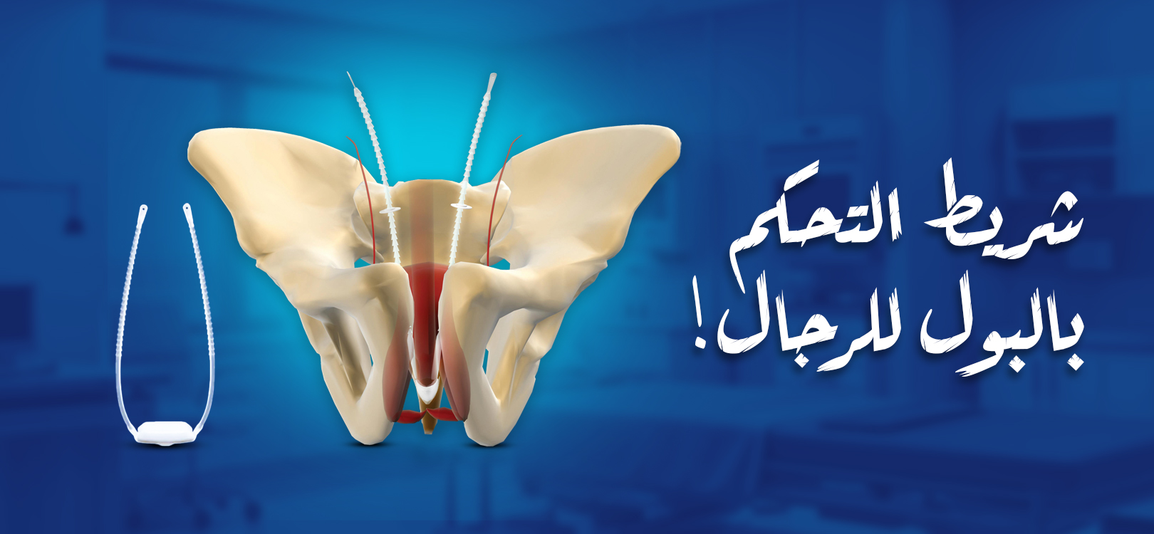 صمام وشريط التحكم في البول