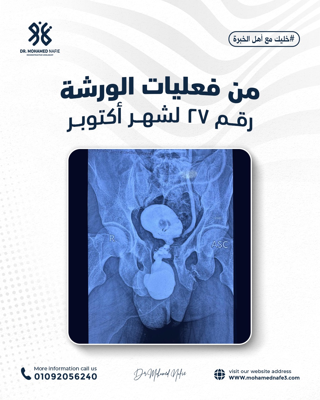 واحدة من أصعب وأدق الورش الجراحية… إنجاز جديد يُضاف إلى سجل النجاح