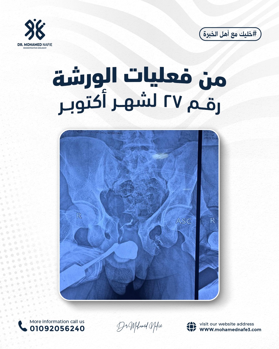 واحدة من أصعب وأدق الورش الجراحية… إنجاز جديد يُضاف إلى سجل النجاح