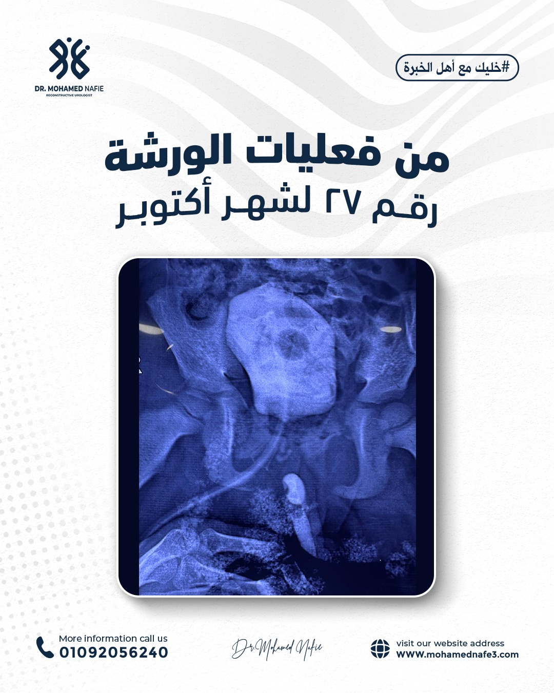 واحدة من أصعب وأدق الورش الجراحية… إنجاز جديد يُضاف إلى سجل النجاح