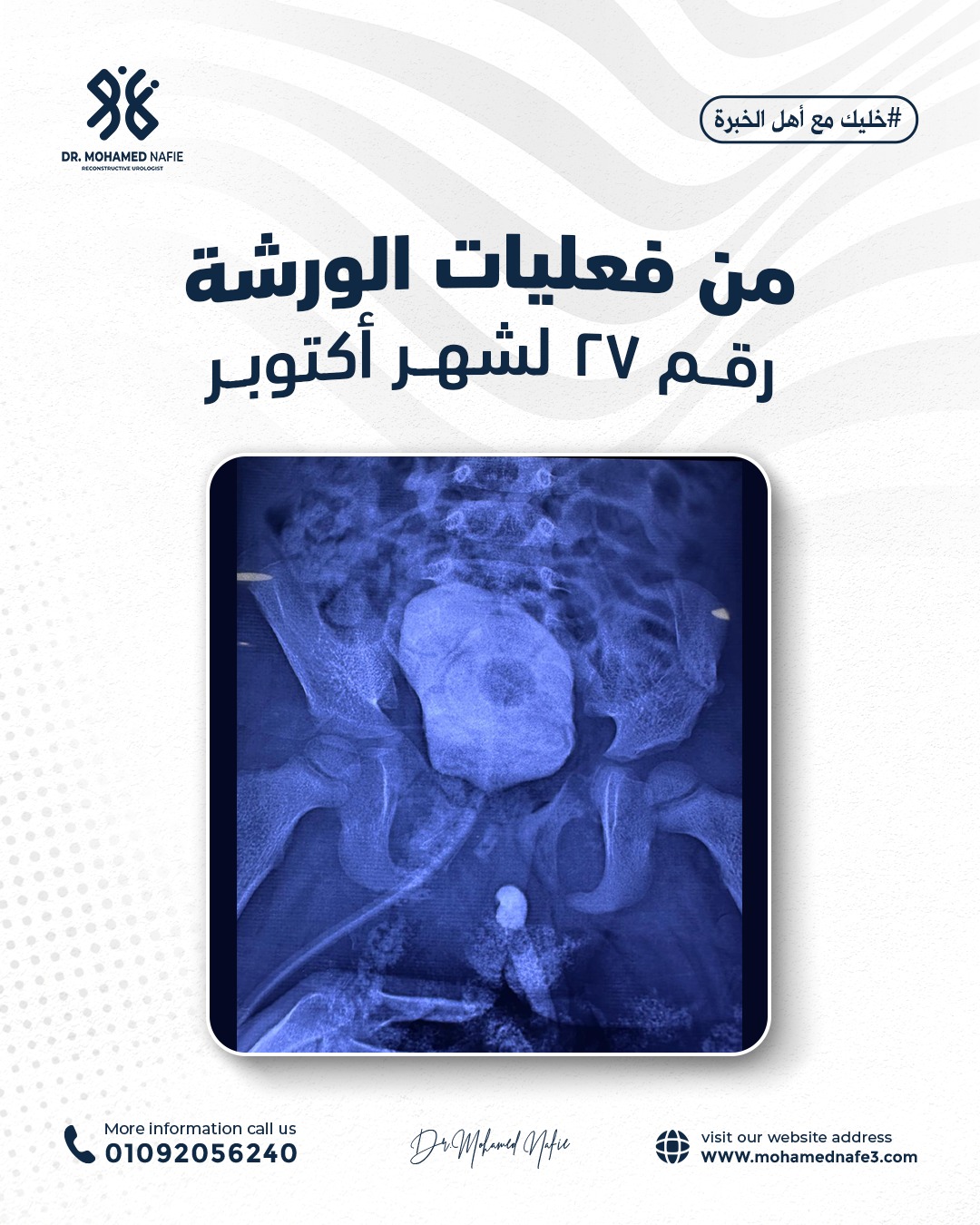 واحدة من أصعب وأدق الورش الجراحية… إنجاز جديد يُضاف إلى سجل النجاح