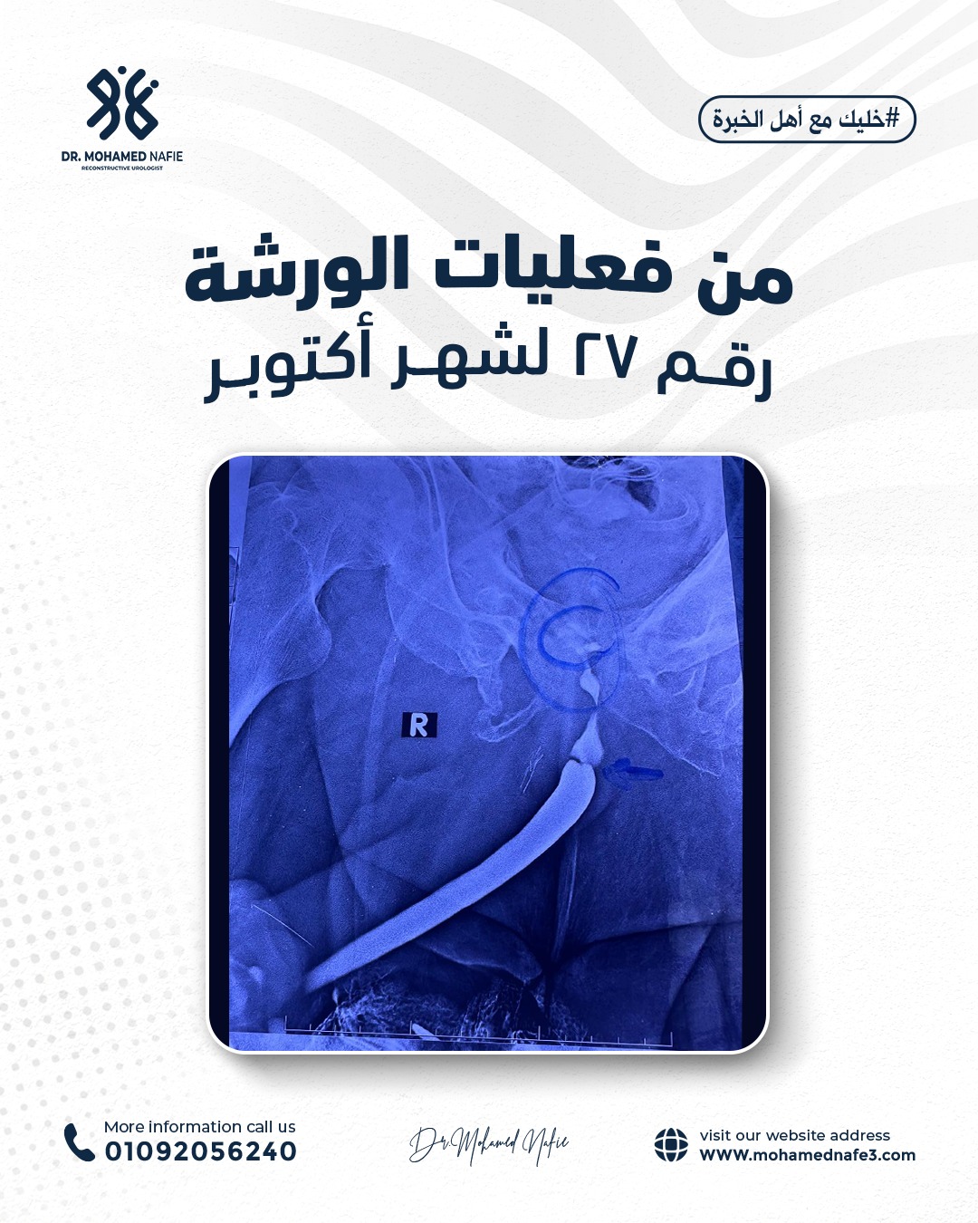 واحدة من أصعب وأدق الورش الجراحية… إنجاز جديد يُضاف إلى سجل النجاح