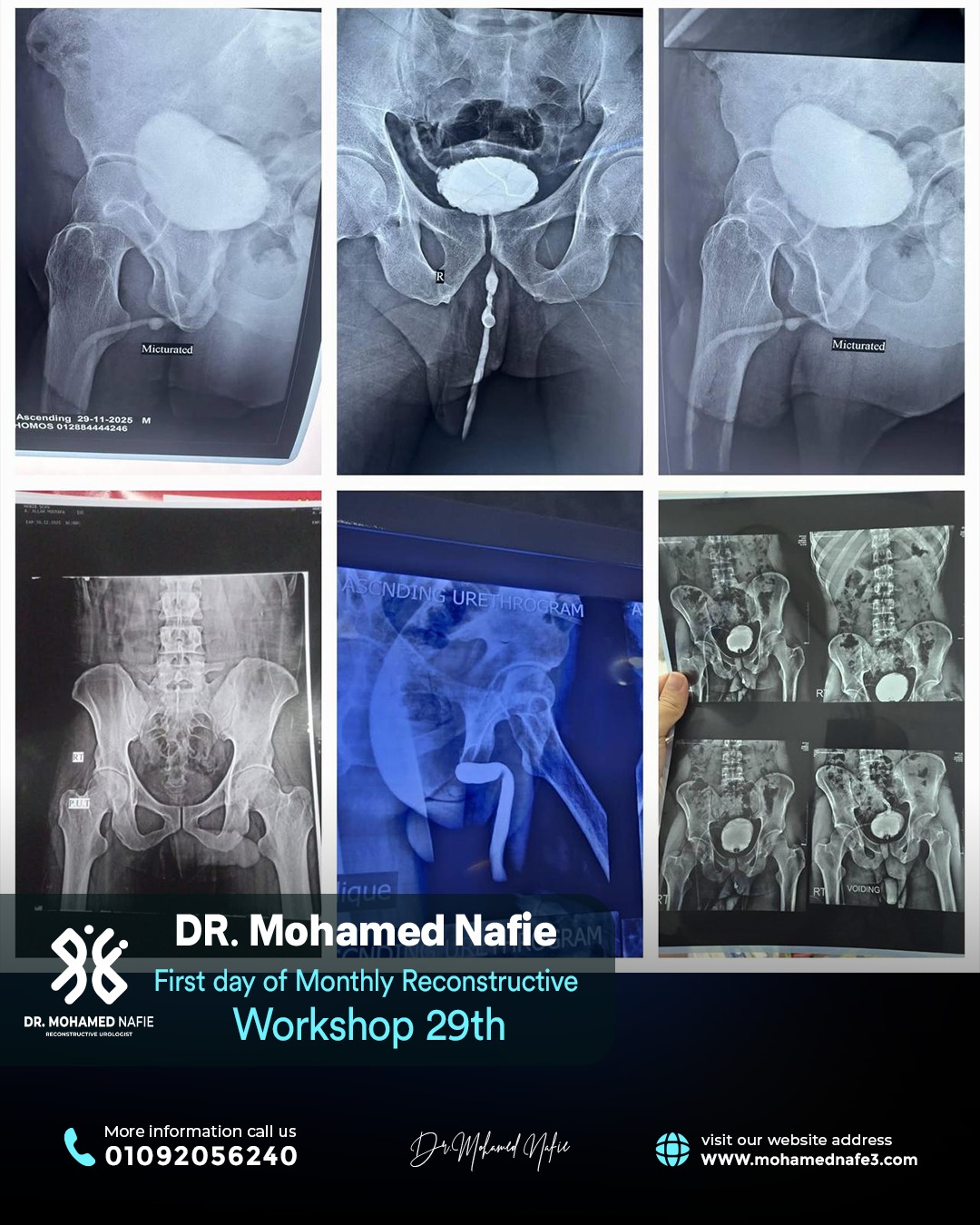 بدأنا الحدث التاريخي… ملحمة طبية تُكتب على أرض مصر