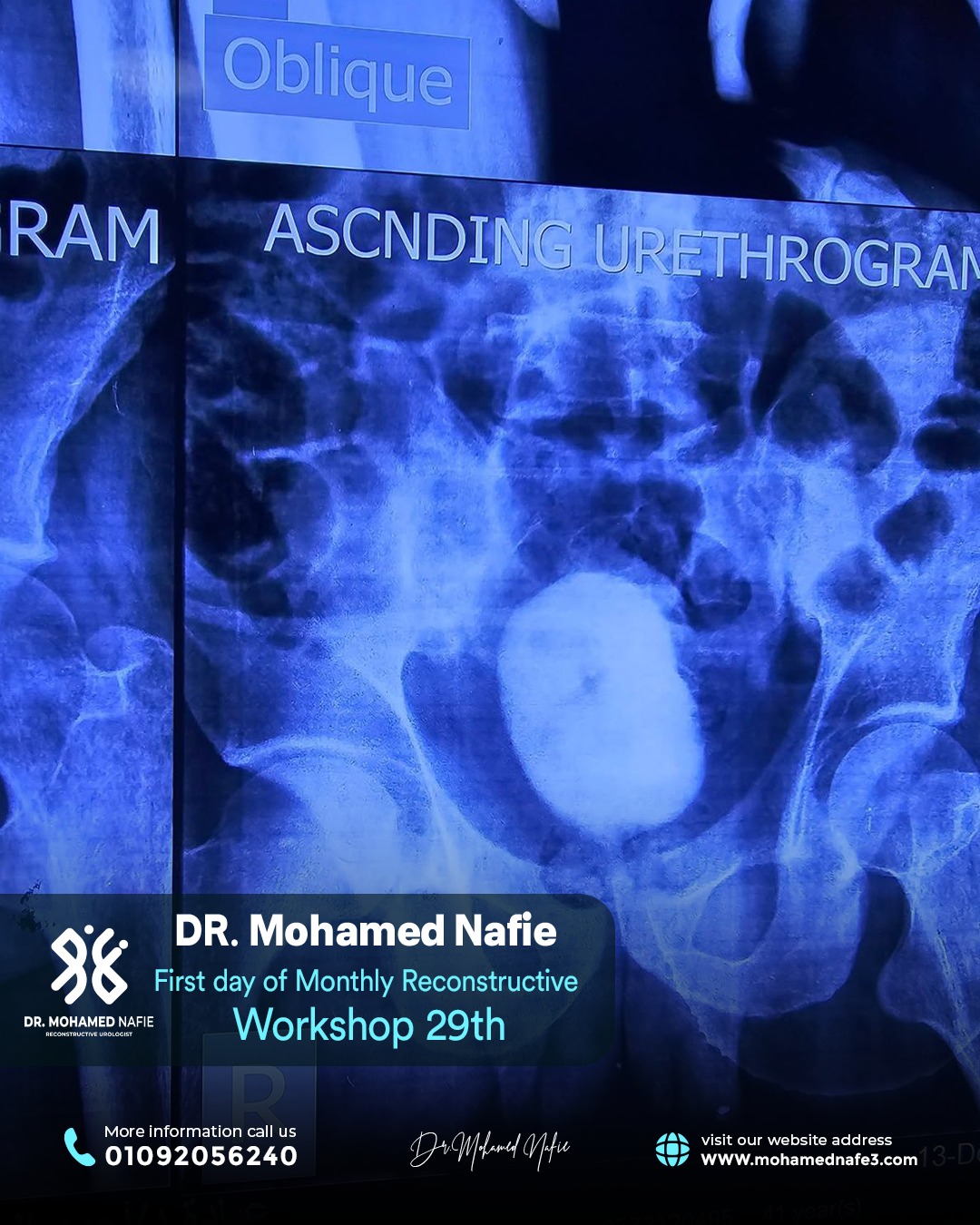 بدأنا الحدث التاريخي… ملحمة طبية تُكتب على أرض مصر