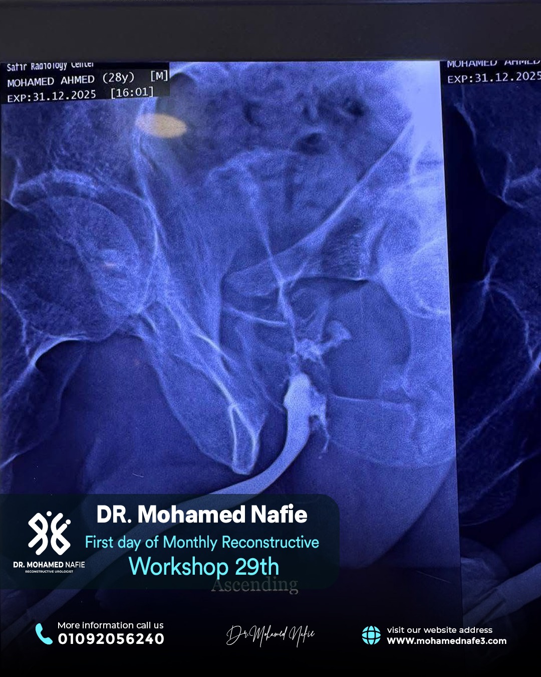 بدأنا الحدث التاريخي… ملحمة طبية تُكتب على أرض مصر