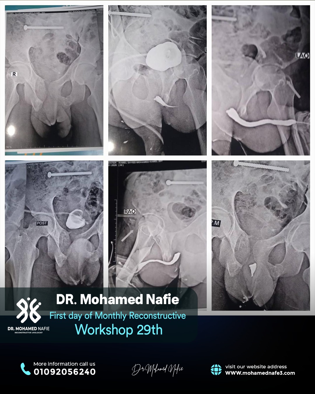 بدأنا الحدث التاريخي… ملحمة طبية تُكتب على أرض مصر