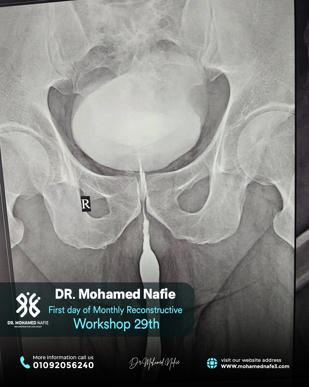 الورشة رقم 29… محطة جديدة في مسيرة التميز الطبي لجراحات مجرى البول