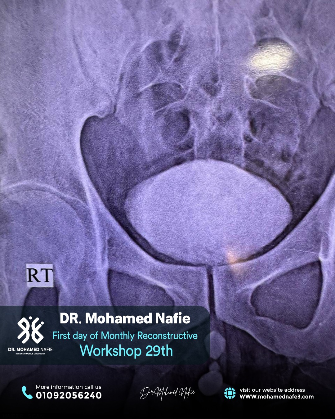 الورشة رقم 29… محطة جديدة في مسيرة التميز الطبي لجراحات مجرى البول