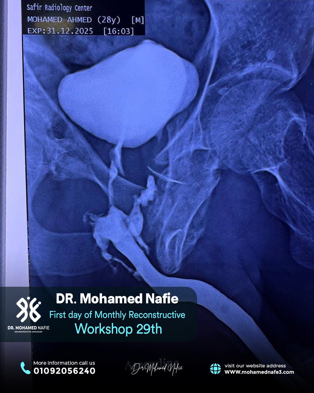 الورشة رقم 29… محطة جديدة في مسيرة التميز الطبي لجراحات مجرى البول