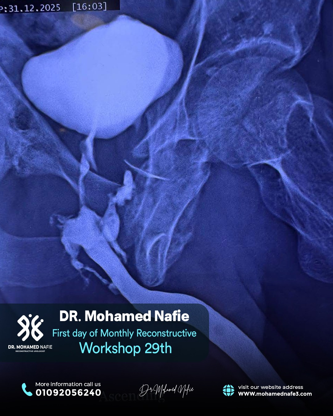 الورشة رقم 29… محطة جديدة في مسيرة التميز الطبي لجراحات مجرى البول