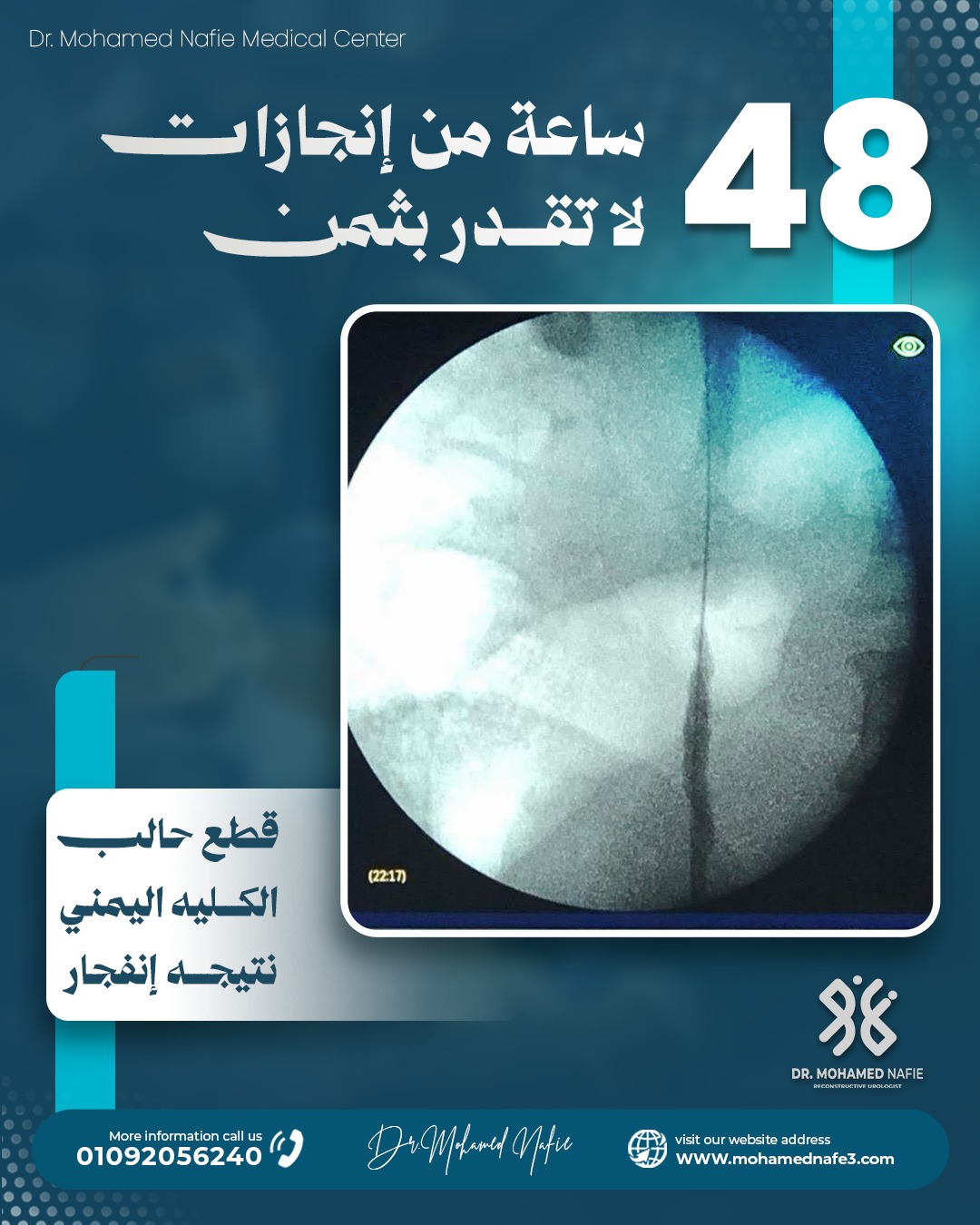 غرفة العمليات تشهد قصص أمل جديدة خلال 48 ساعة في مركز دكتور محمد نافع