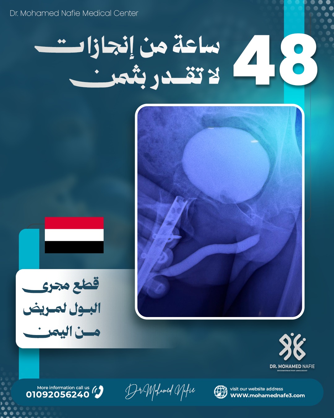 غرفة العمليات تشهد قصص أمل جديدة خلال 48 ساعة في مركز دكتور محمد نافع