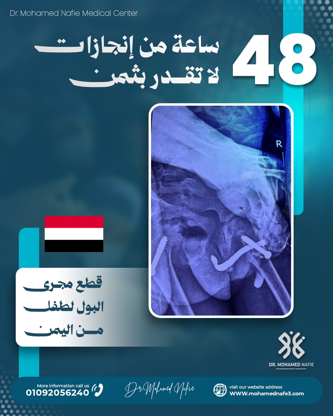 غرفة العمليات تشهد قصص أمل جديدة خلال 48 ساعة في مركز دكتور محمد نافع