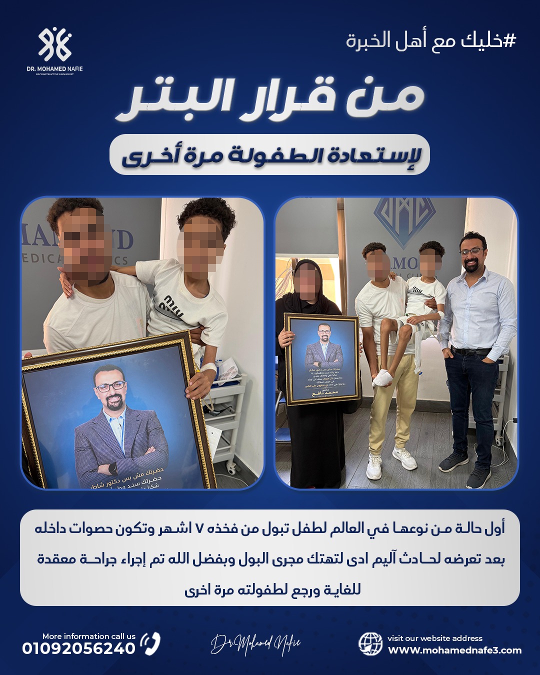  أول حالة في العالم لطفل يتبول من الفخذ وتكوّنت حصوات داخل الفخذ.. جراحة نادرة أعادت إليه طفولته