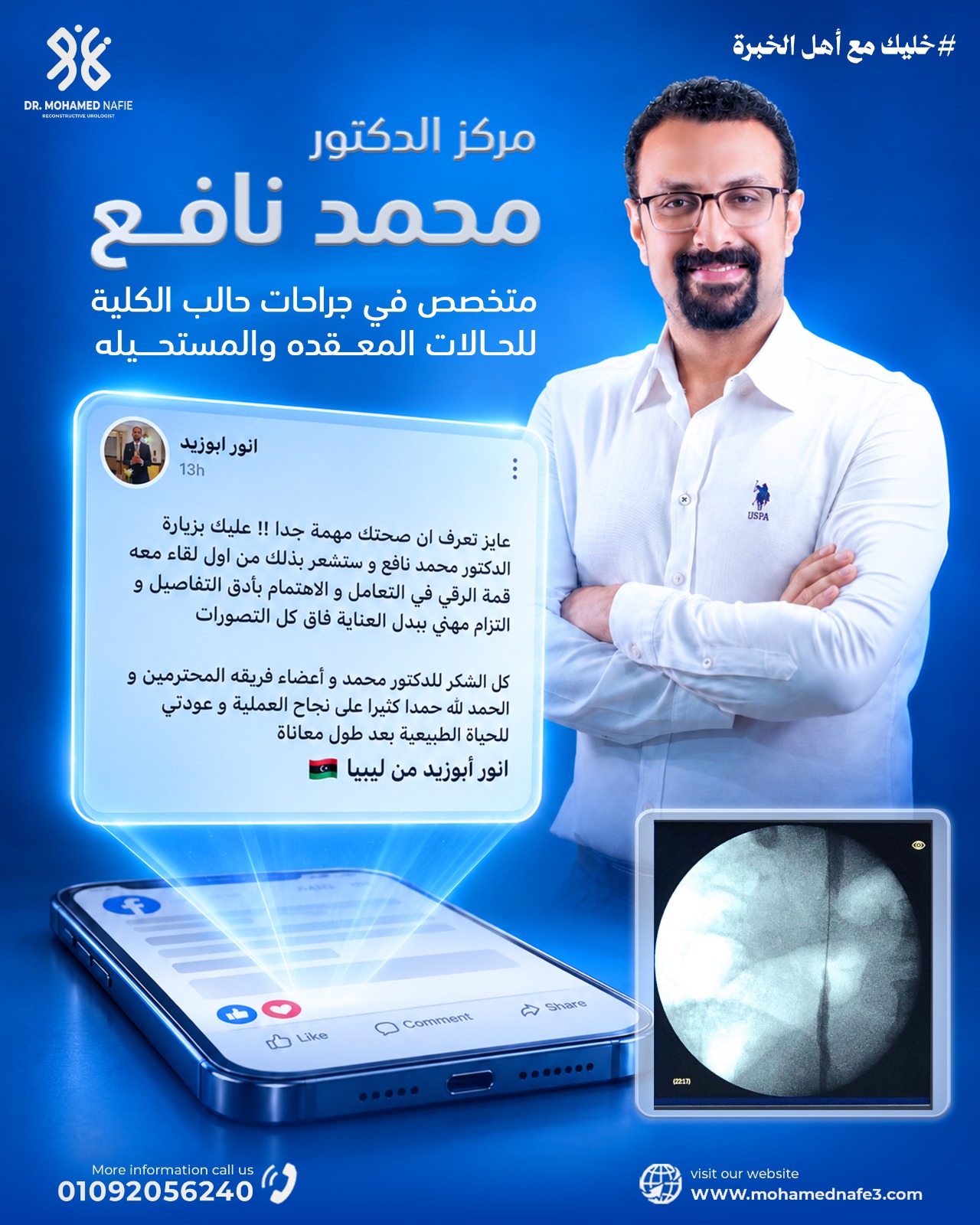  مريض ليبي استعاد وظائف الكلية بعد استبدال 12 سم كاملة من الحالب باستخدام بطانة الفم بطريقة د. نافع الحديثة